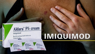 imiquimod